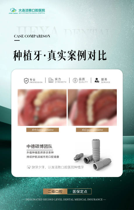 源文件下載【享設計】搜索編號：43500030455501747【口腔種植牙案例對比海報】