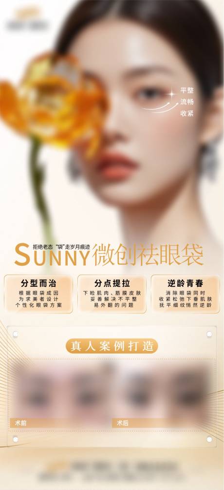 源文件下载【微创祛眼袋】编号：14060030111445262