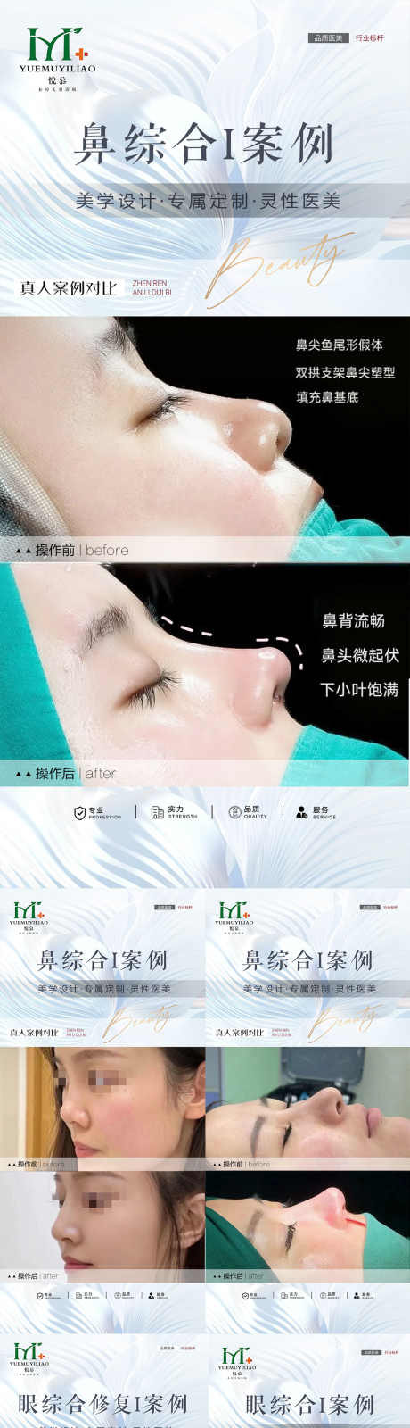 源文件下載【整形案例海報】編號：88950030236202452