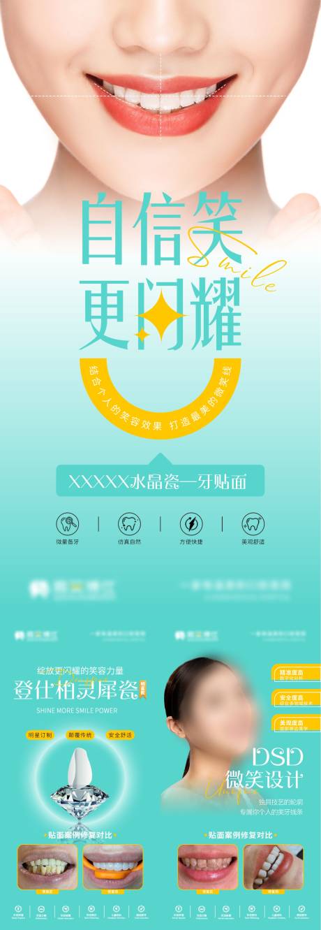 源文件下载【牙贴面美牙海报】编号：91200029878391899