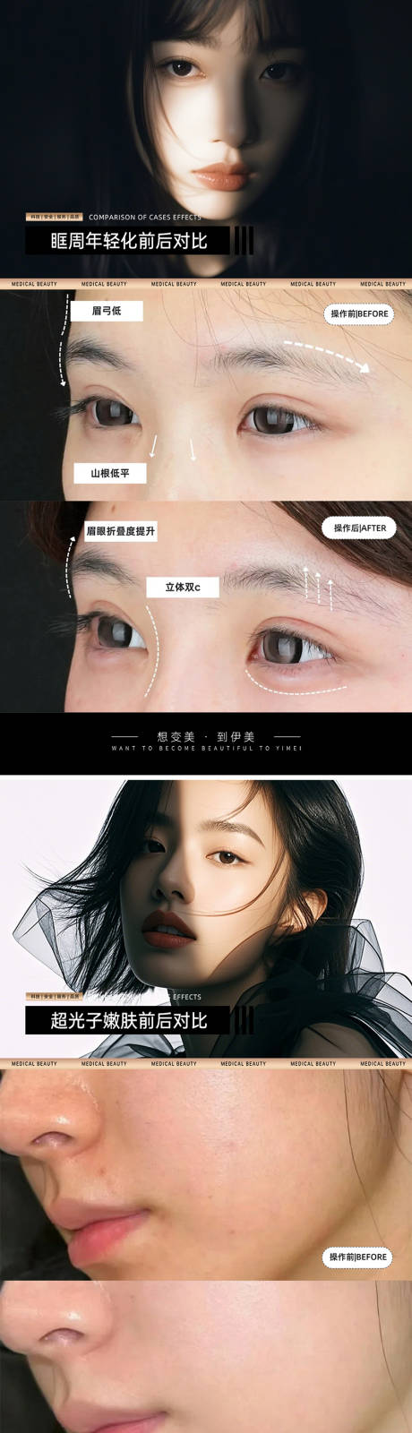 源文件下载【医美案例对比模板】编号：52110030421134953