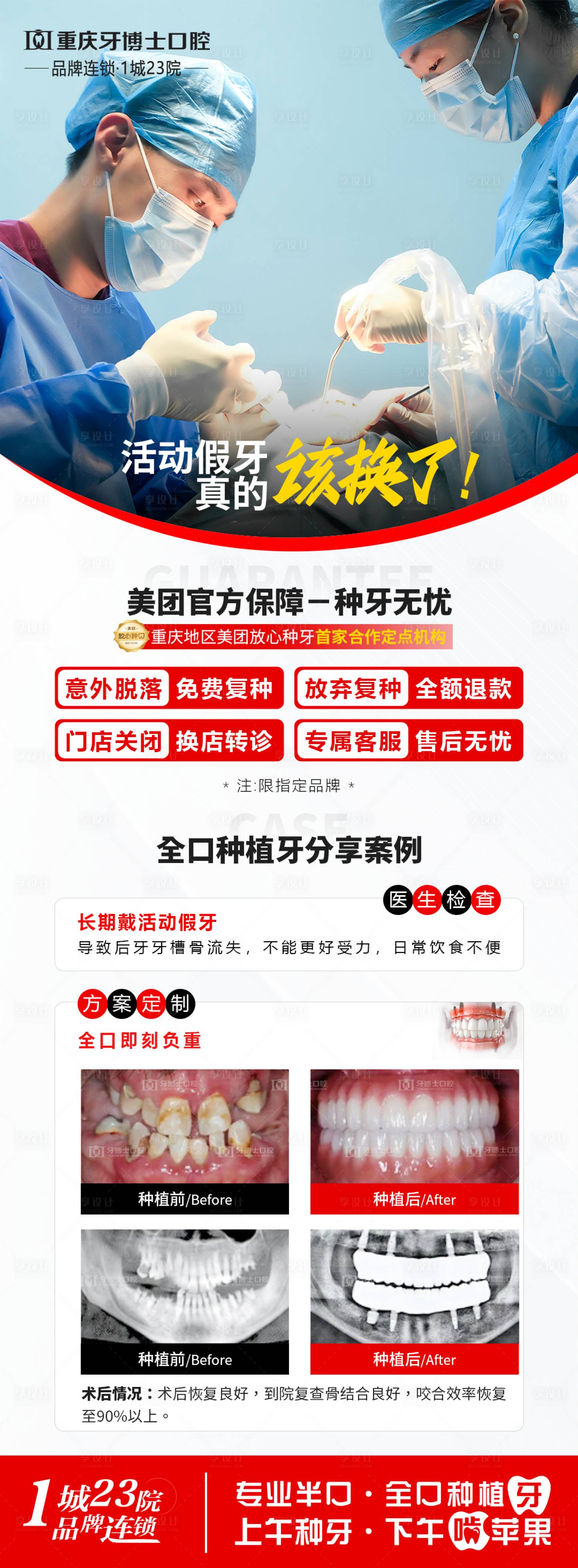 源文件下载【口腔种牙宣传海报】编号：58230030094487982