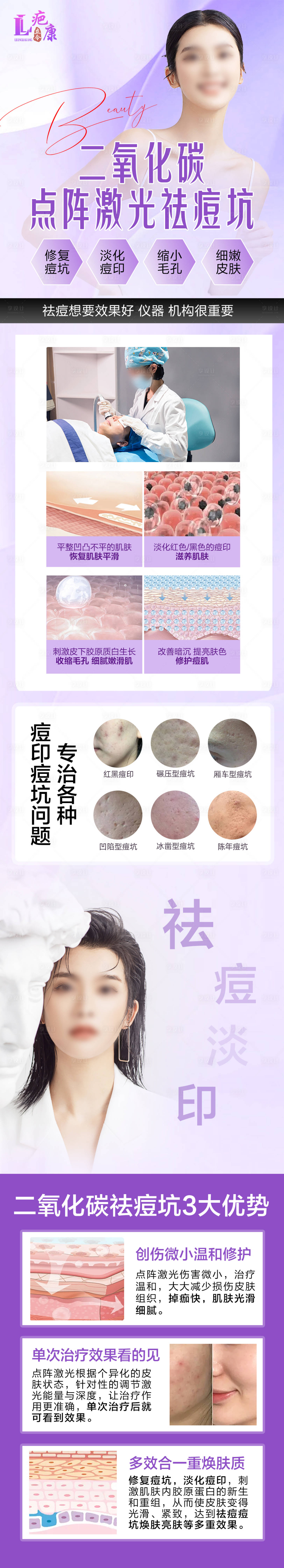 源文件下載【享設計】搜索編號：77370030052659508【二氧化碳點陣激光祛痘坑詳情頁】