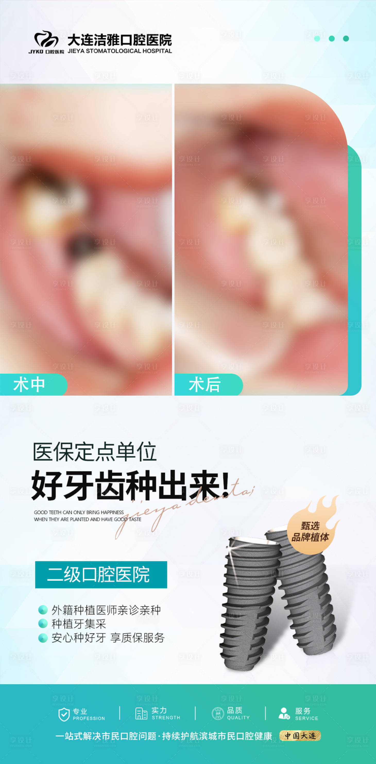 源文件下载【享设计】搜索编号：10340030274232177【口腔种植牙案例对比海报】