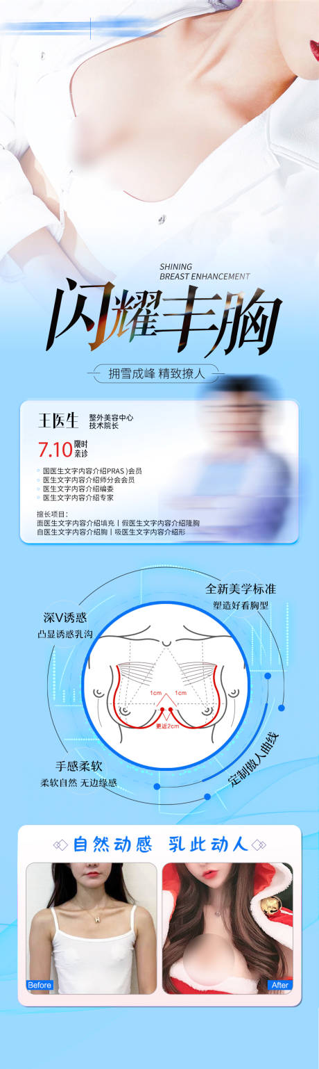 源文件下载【丰胸专家案例长图】编号：13510030397145772