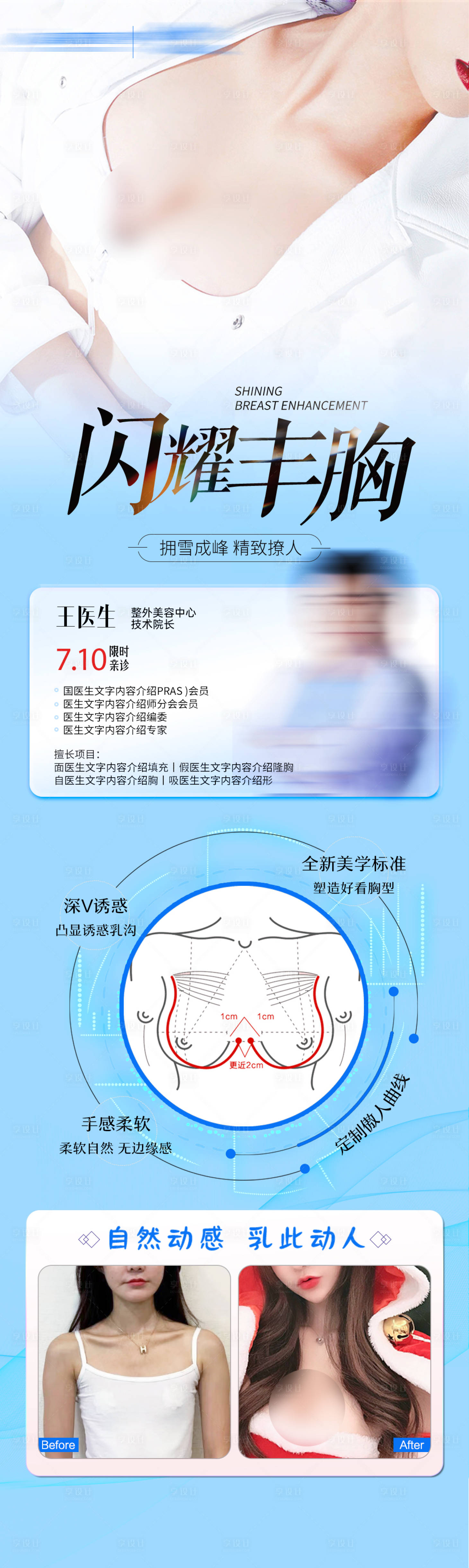 源文件下载【享设计】搜索编号：13510030397145772【丰胸专家案例长图】