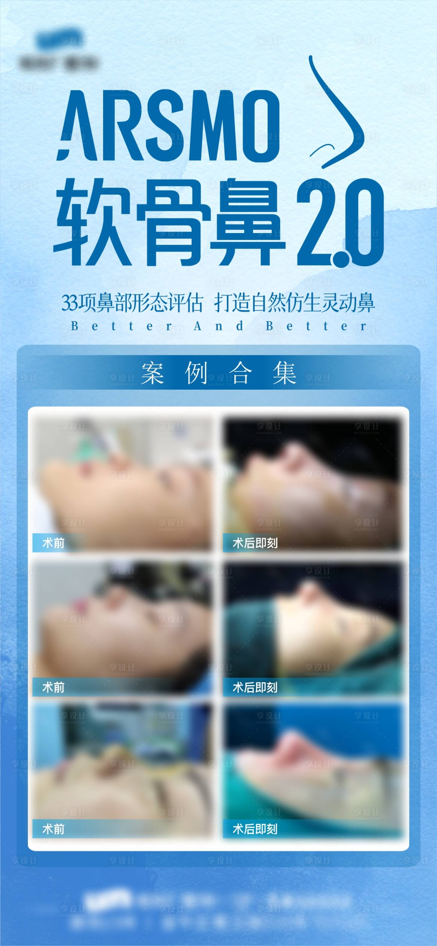 源文件下載【享設計】搜索編號：72930030111291204【隆鼻】
