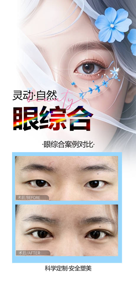 源文件下载【医美眼综合案例海报】编号：68700030398304233