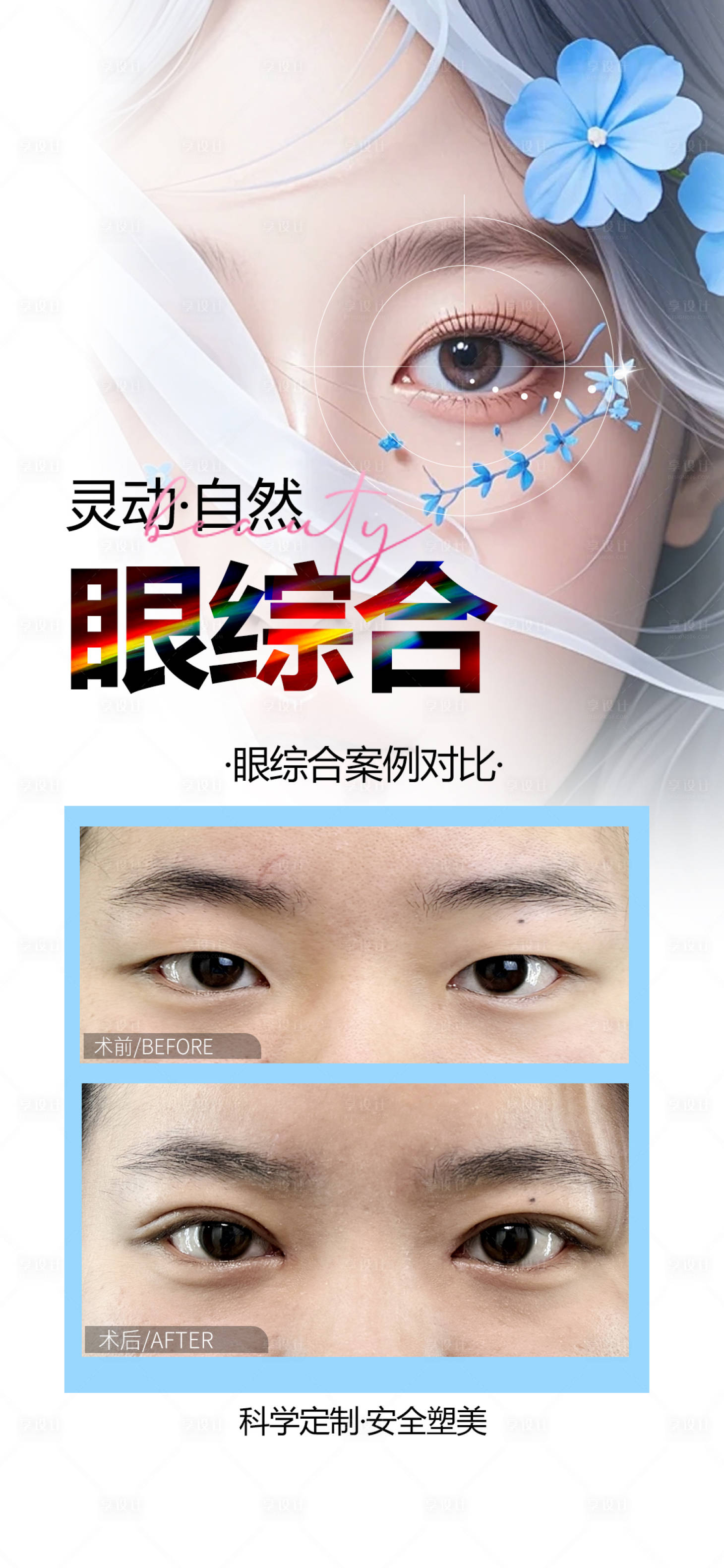 源文件下載【享設計】搜索編號：68700030398304233【醫美眼綜合案例海報】