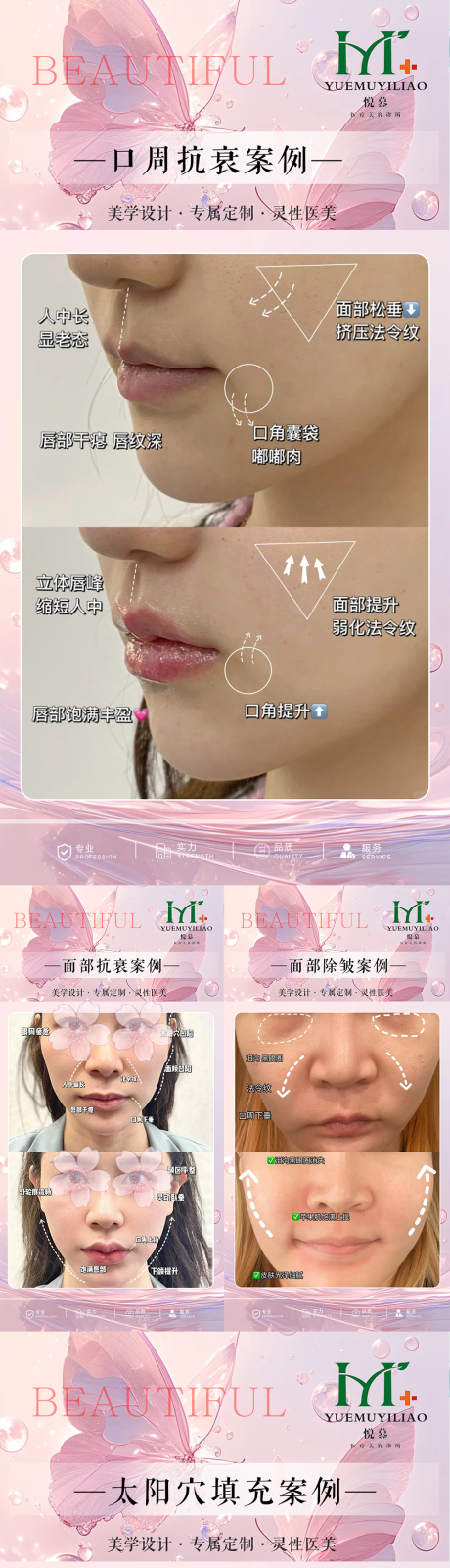 源文件下载【医美案例对比海报】编号：56710030413311172
