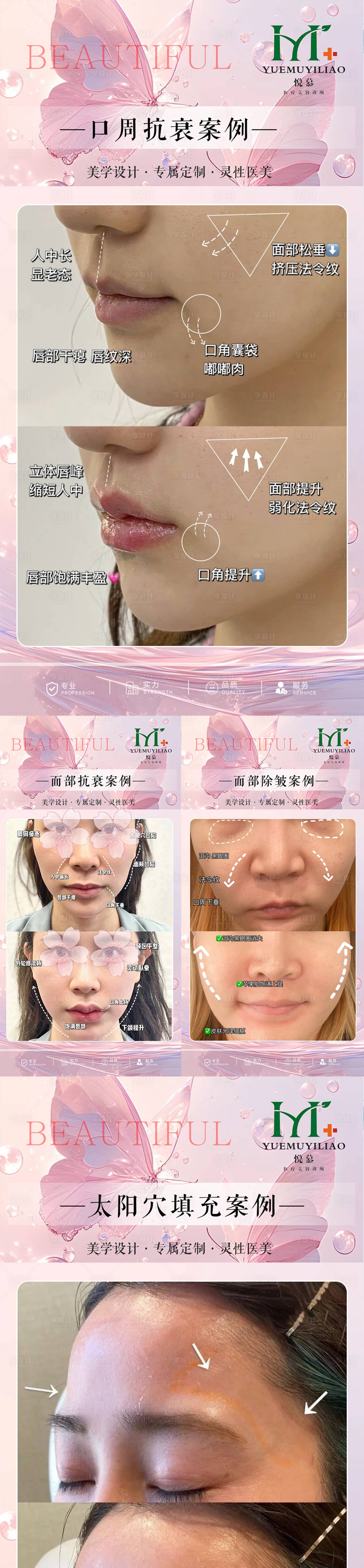 源文件下载【享设计】搜索编号：56710030413311172【医美案例对比海报】