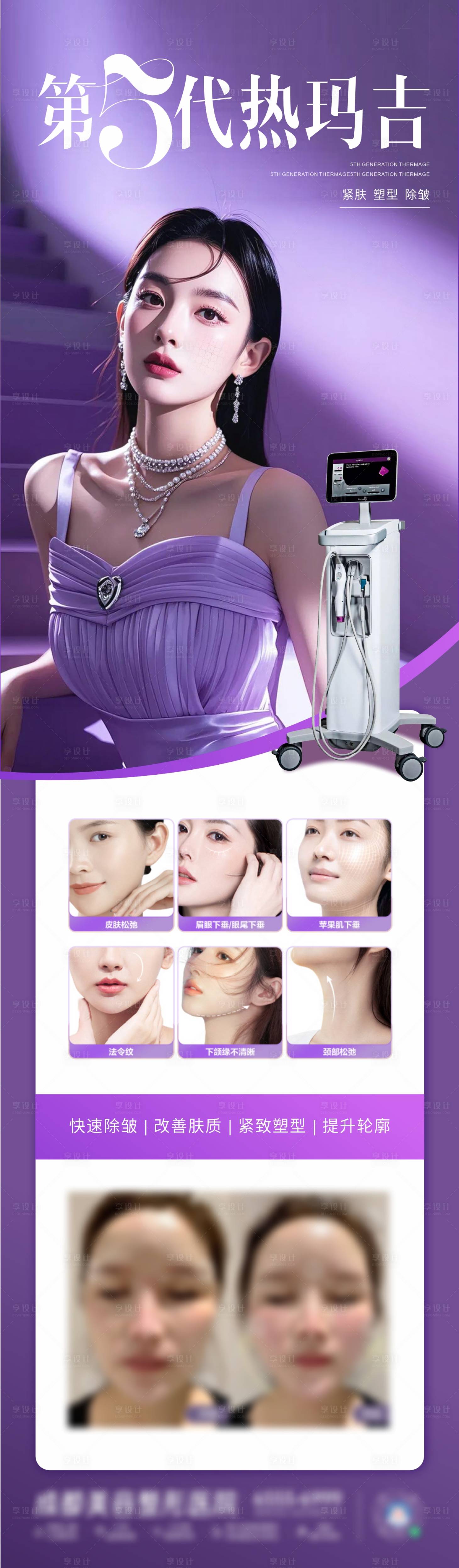 源文件下载【享设计】搜索编号：55440029953391019【医美热玛吉仪器长图】