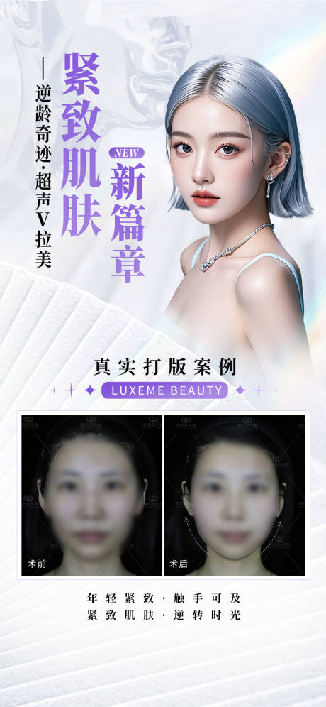 超声V拉美