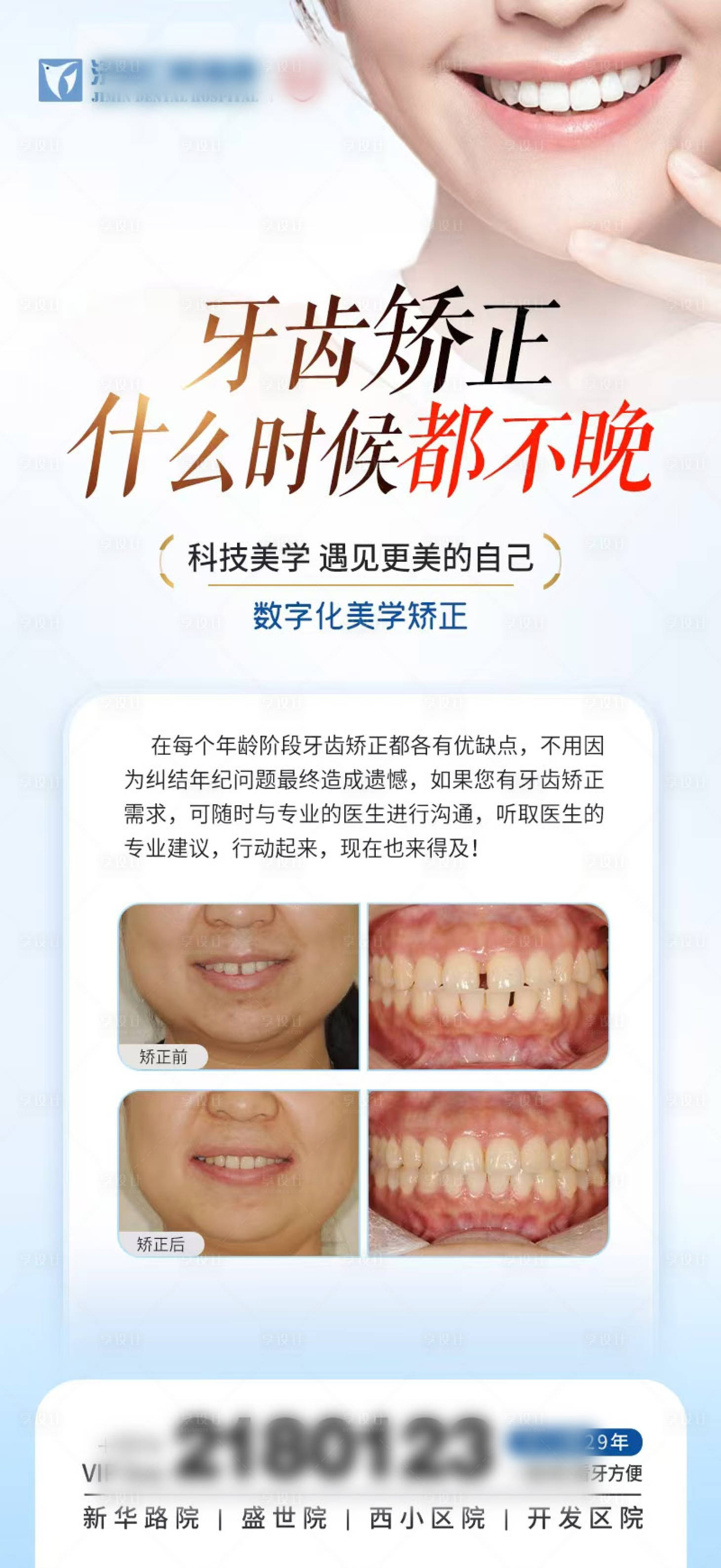 源文件下载【享设计】搜索编号：11910029974751146【牙齿矫正海报案例】