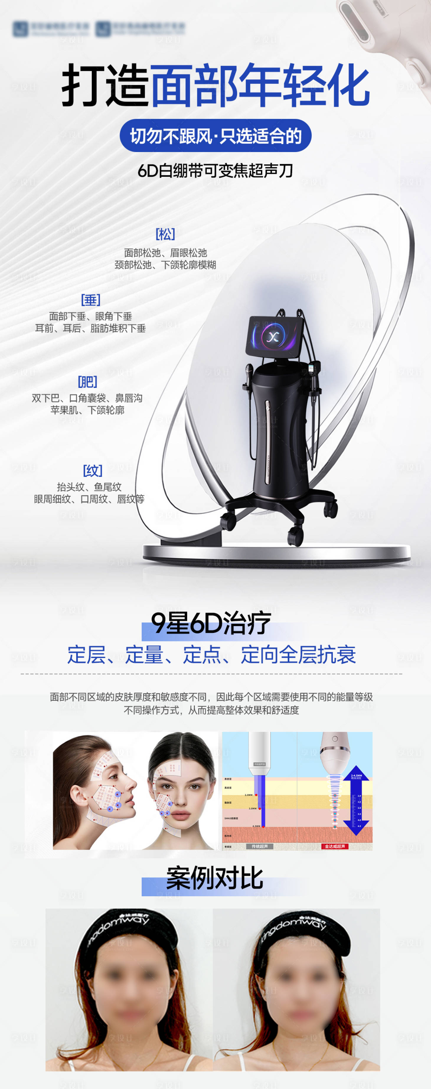 源文件下载【享设计】搜索编号：93050030233838149【医美仪器介绍聚拉提海报】