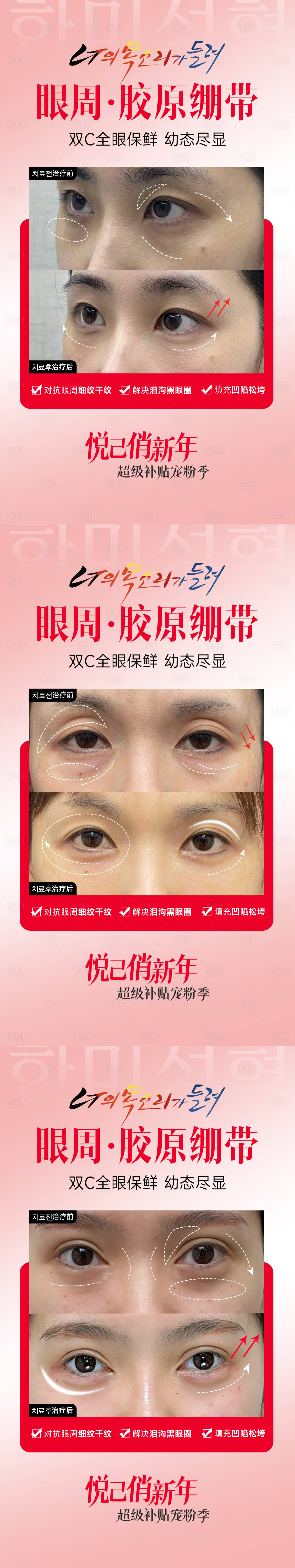 源文件下載【享設(shè)計】搜索編號：60090030415544714【醫(yī)美眼周膠原繃帶案例海報】