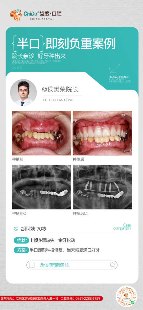 源文件下载【口腔种植牙专家案例模板】编号：33250029955508541
