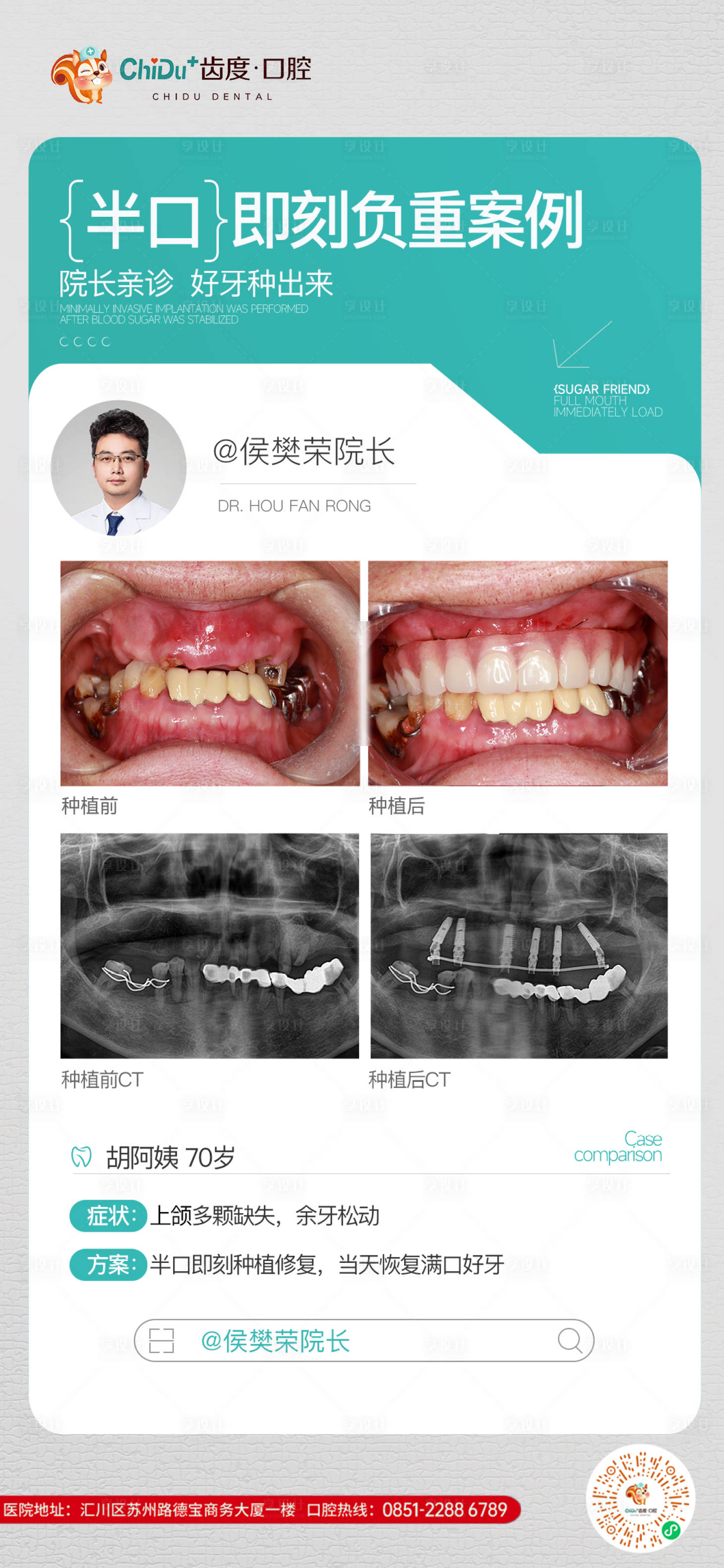 源文件下载【享设计】搜索编号：33250029955508541【口腔种植牙专家案例模板】