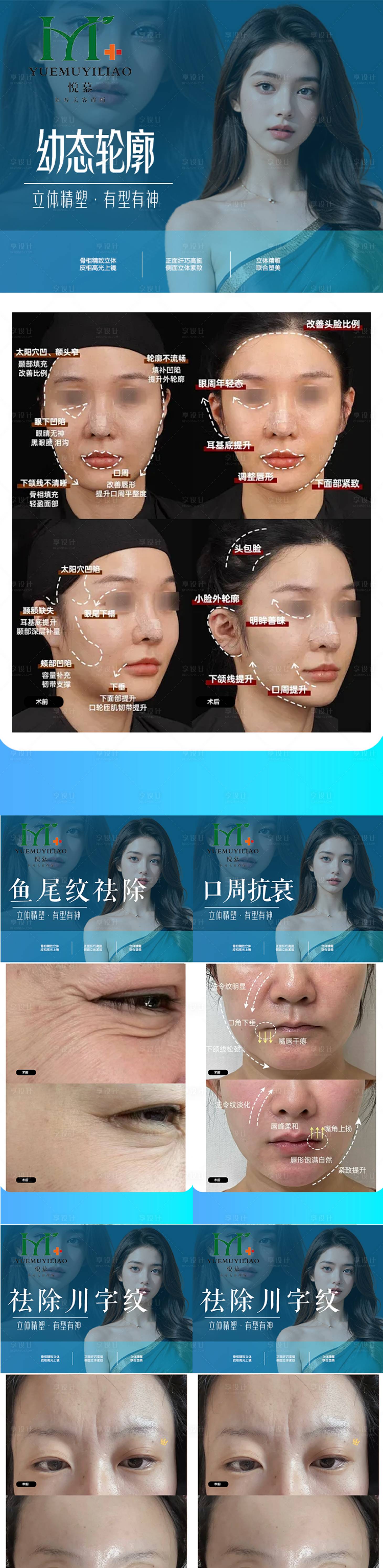 源文件下載【享設計】搜索編號：75430030133121133【整形案例】