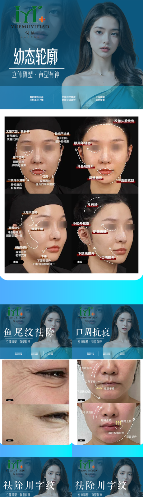 整形案例