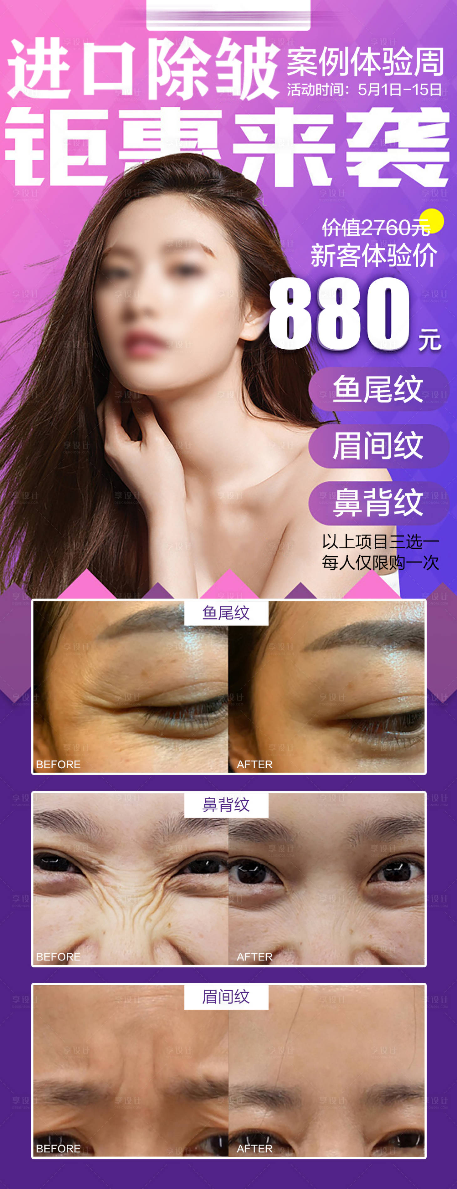 源文件下载【享设计】搜索编号：54990029927733858【医美除皱案例海报】