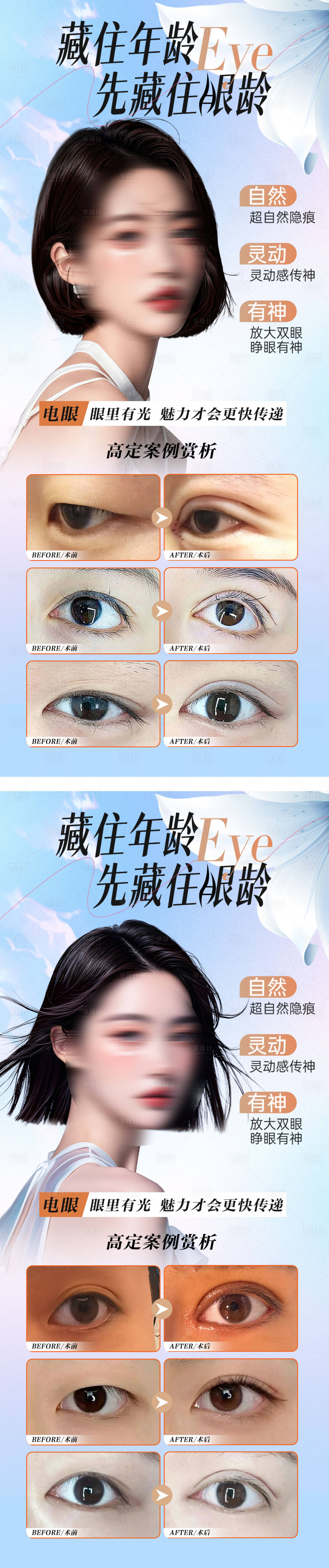 源文件下载【享设计】搜索编号：35530030492123560【医美双眼皮案例海报】