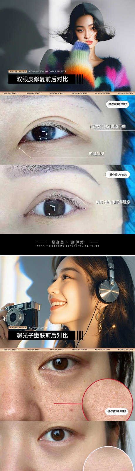源文件下載【享設計】搜索編號：24060030442221036【醫美案例對比模板】