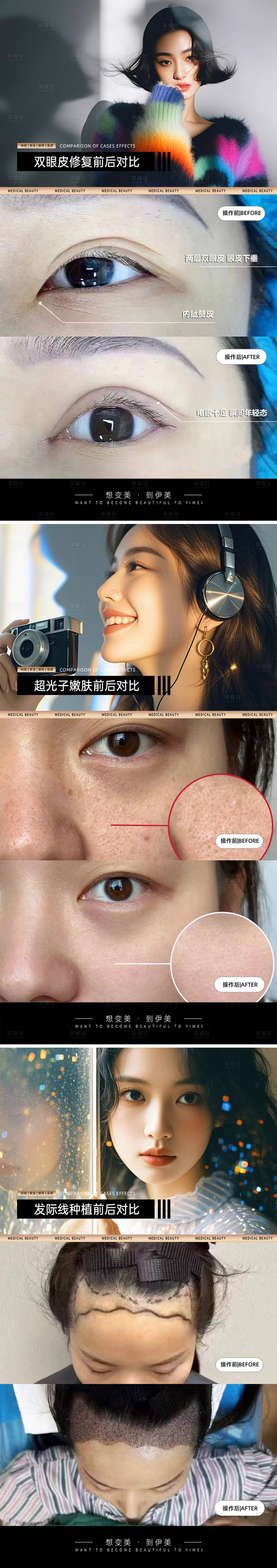 源文件下載【享設(shè)計】搜索編號：24060030442221036【醫(yī)美案例對比模板】
