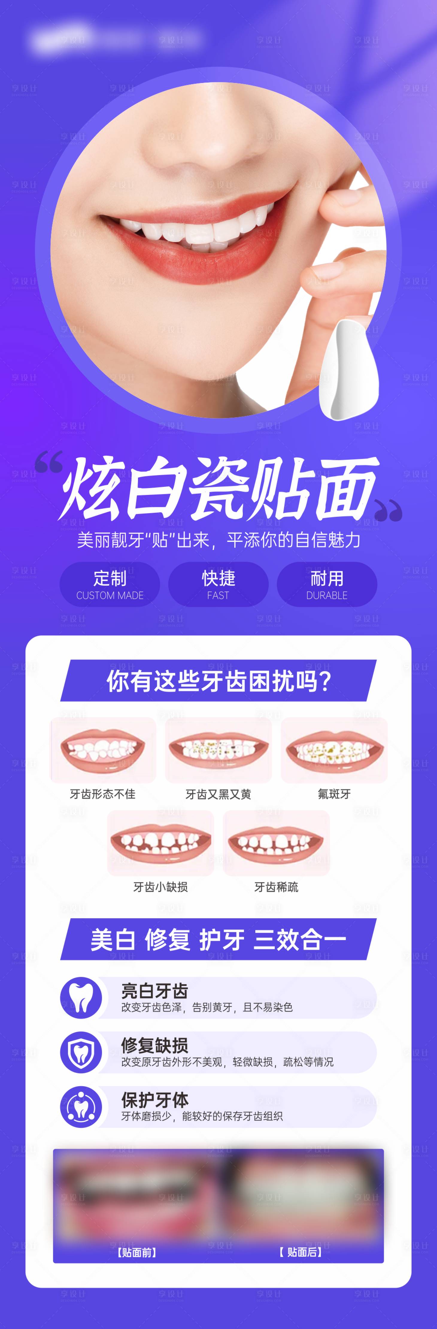 源文件下载【享设计】搜索编号：41300029916807031【炫白瓷贴面】