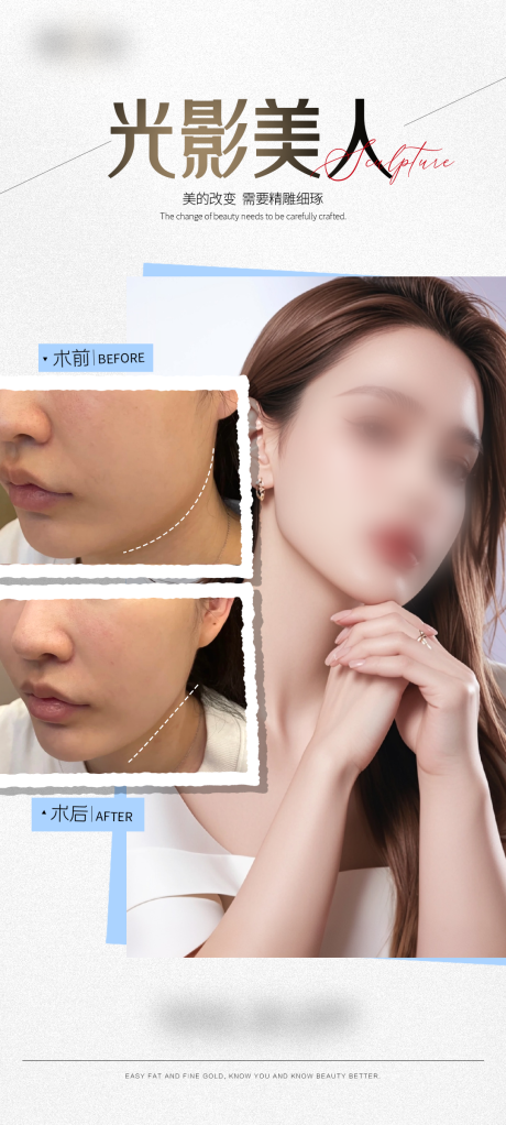 源文件下载【享设计】搜索编号：98570029922969750【医美V脸案例海报】