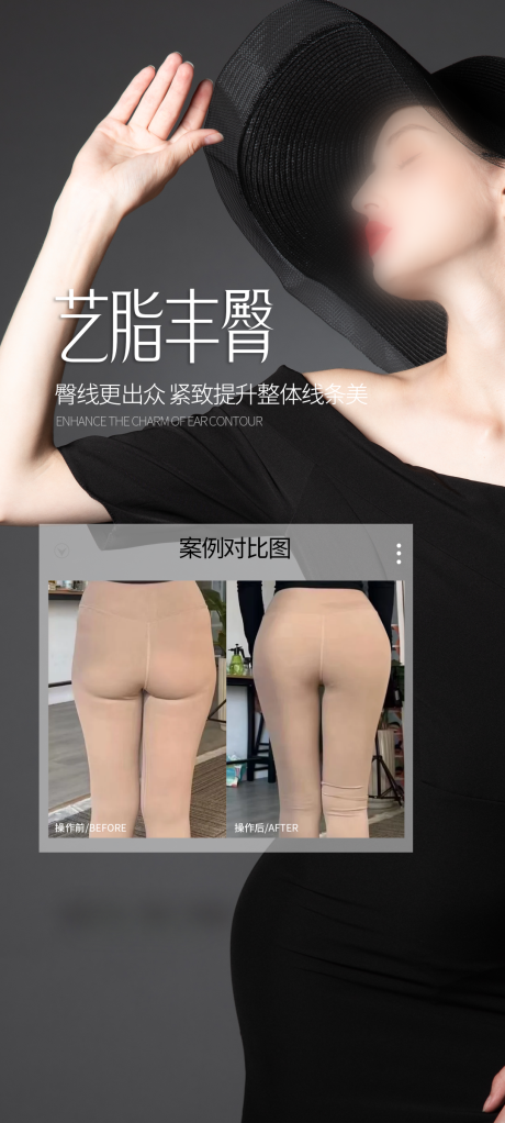 源文件下载【享设计】搜索编号：35960030488013486【医美丰臀案例海报】