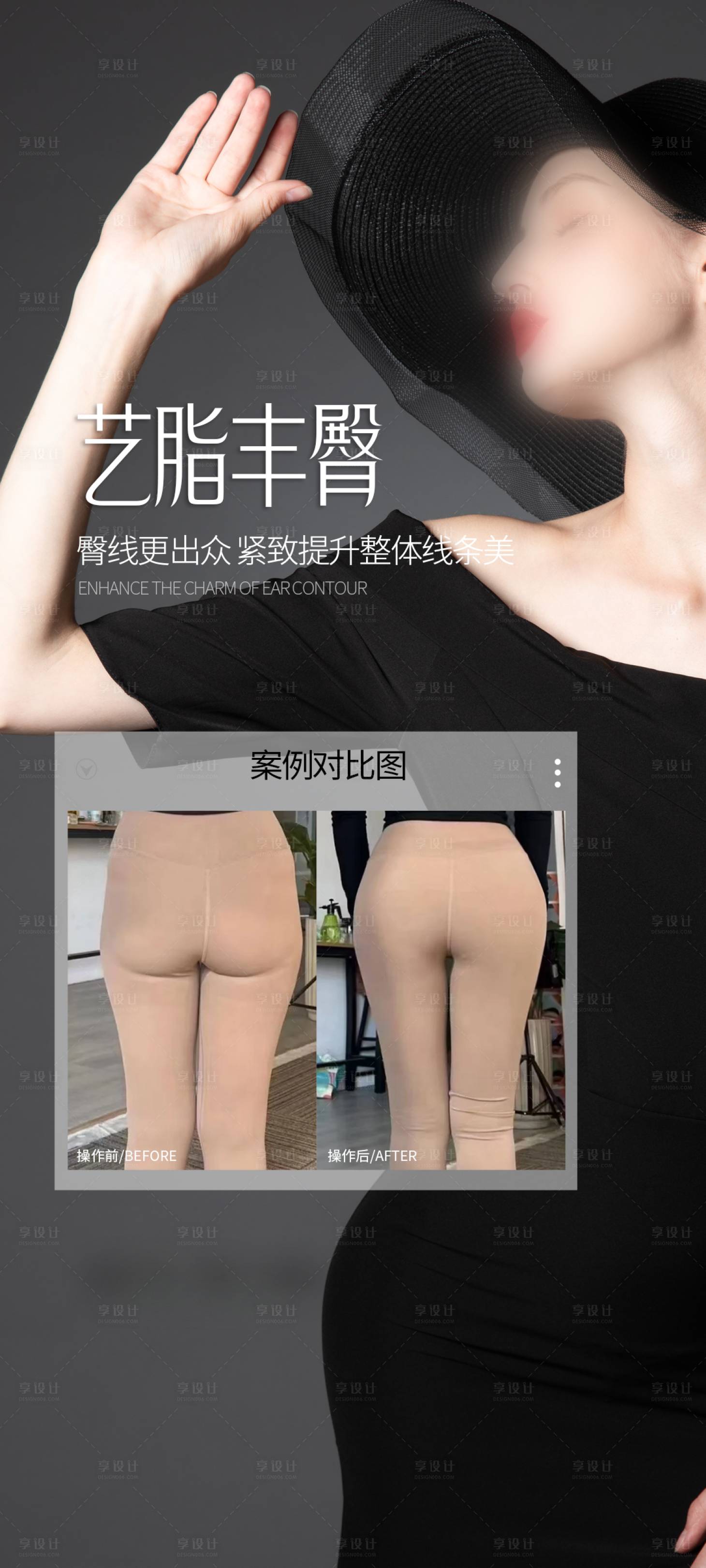 源文件下载【享设计】搜索编号：35960030488013486【医美丰臀案例海报】