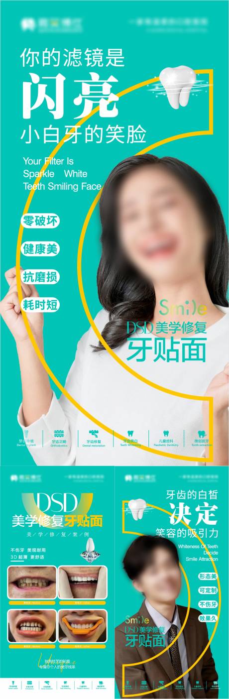 源文件下载【牙贴面美牙】编号：44660029879486490