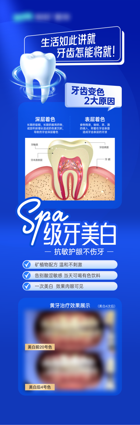 源文件下載【美白牙齒】編號：90180029916702996