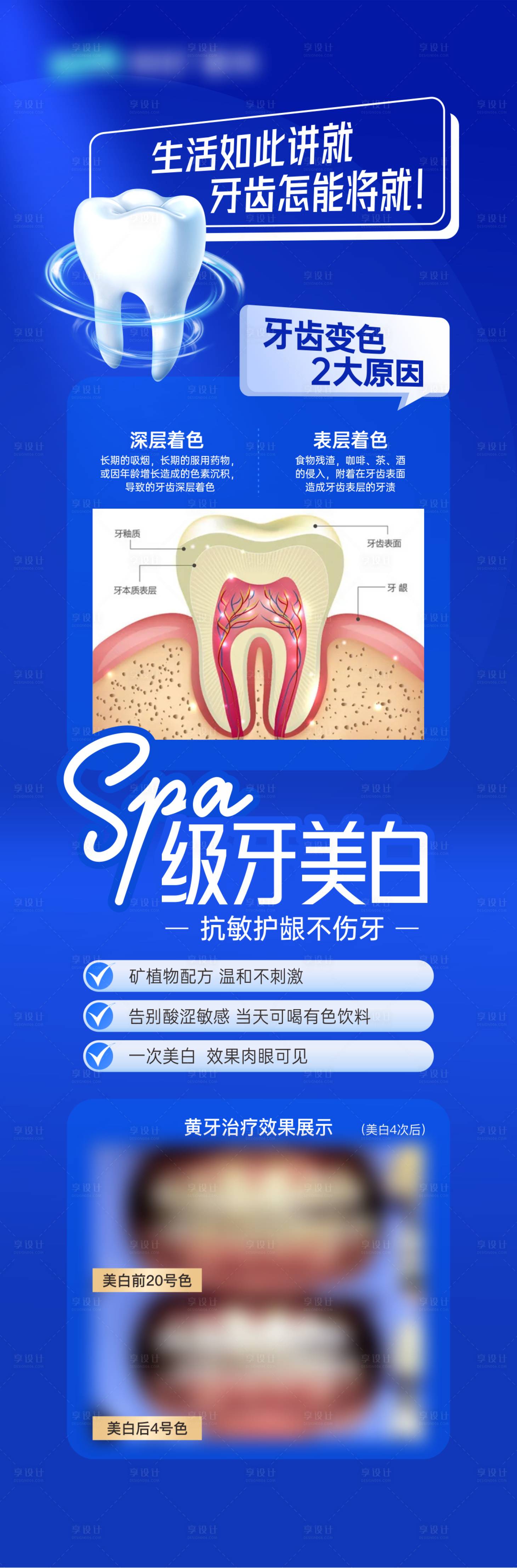源文件下載【美白牙齒】編號：90180029916702996