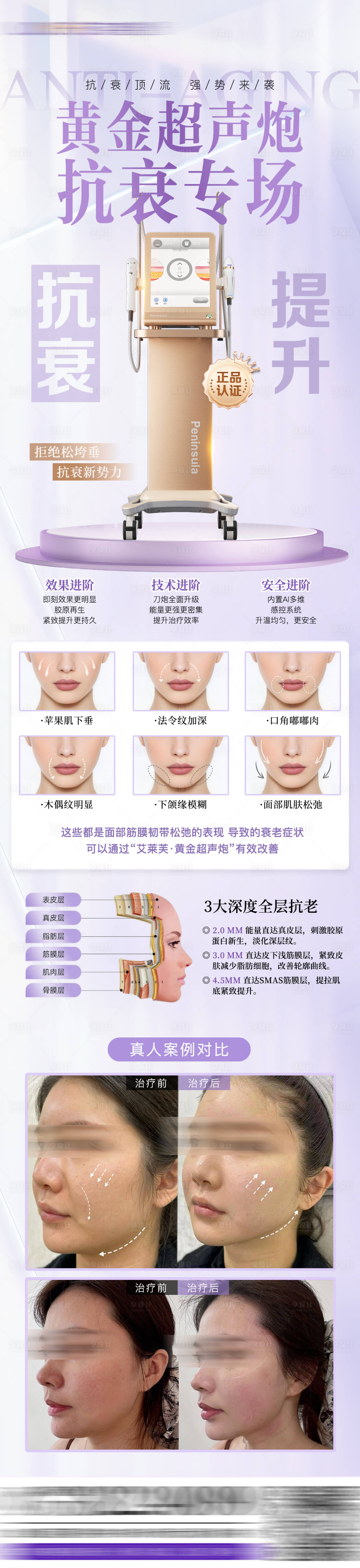 源文件下載【享設計】搜索編號：85180030376288363【黃金超聲炮海報】