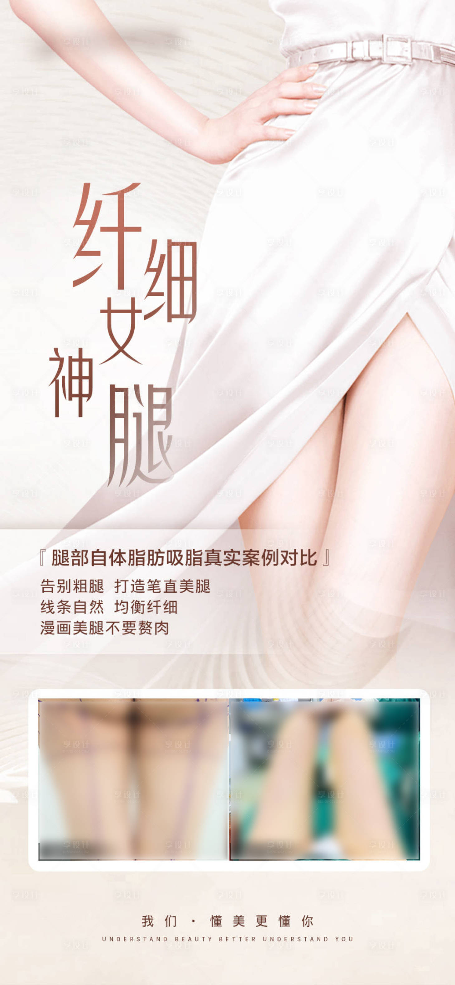 源文件下载【享设计】搜索编号：32670030370572488【腿部吸脂案例对比海报】