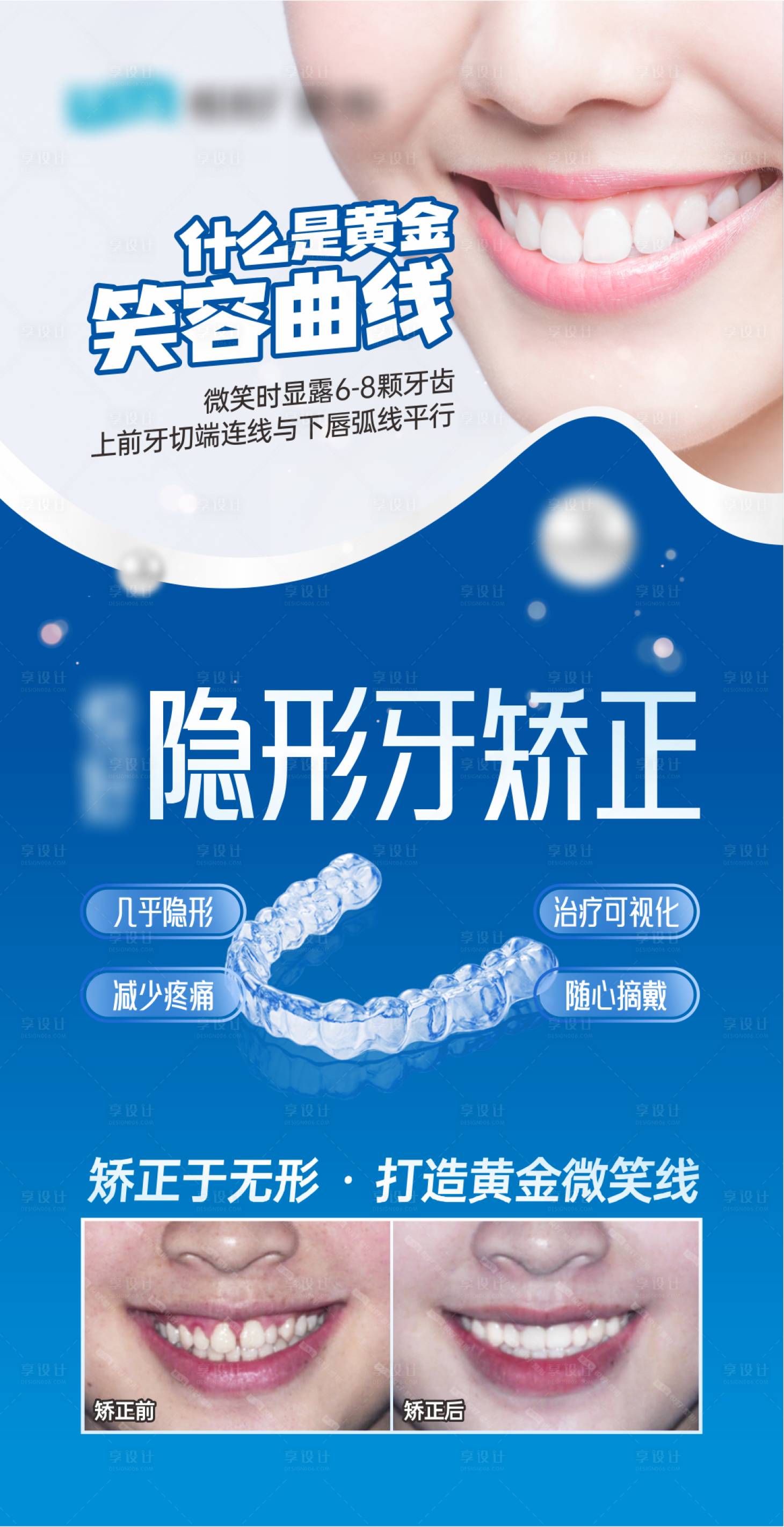 源文件下載【享設(shè)計】搜索編號：39970029914154390【隱形牙矯正海報】