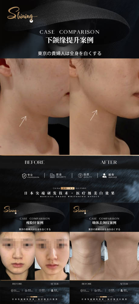 源文件下载【轻医美黑金案例系列海报】编号：50700030182848666