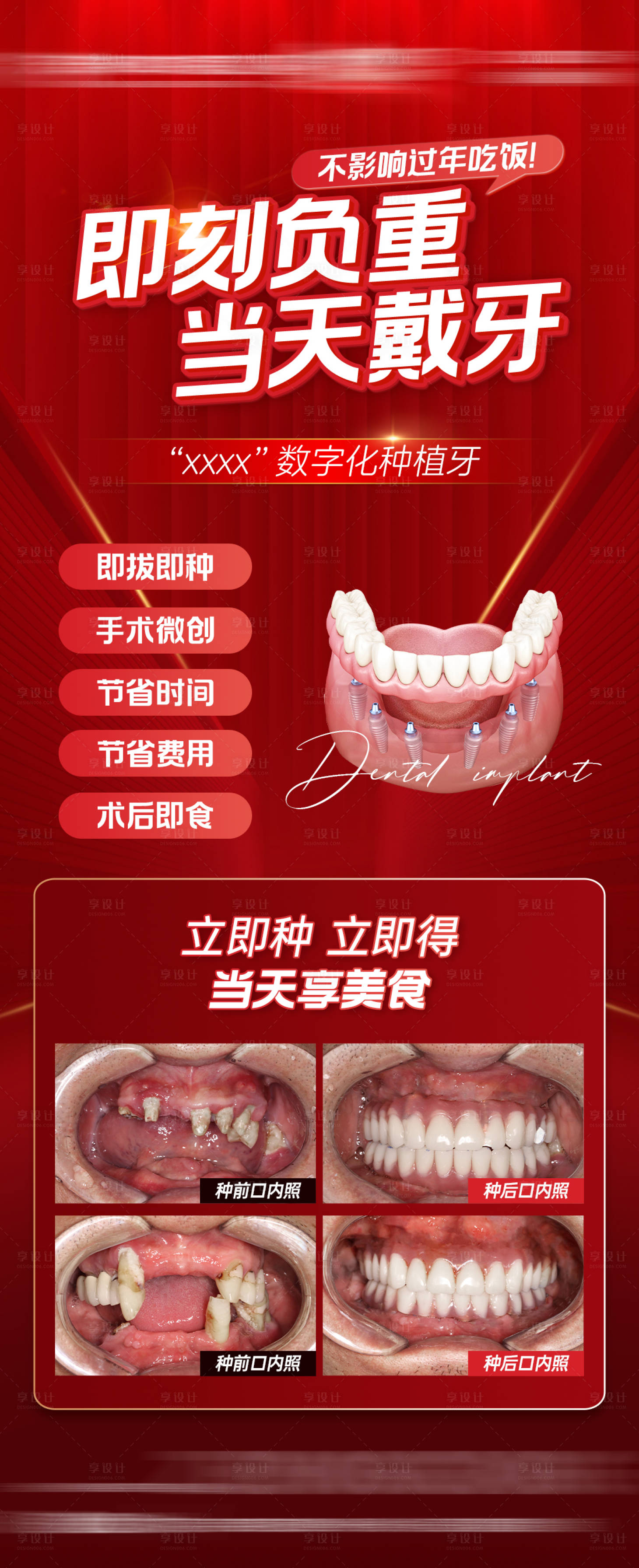源文件下載【享設計】搜索編號：24890030224331337【即刻負重 】