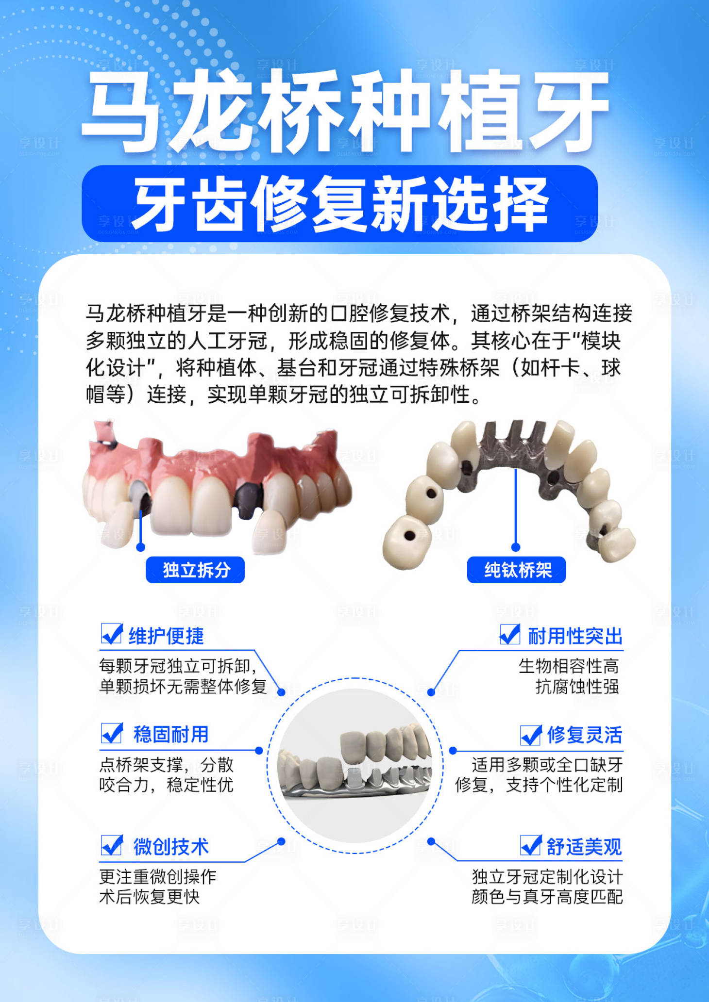 源文件下载【享设计】搜索编号：51290029958684110【马龙桥种植牙科普海报】