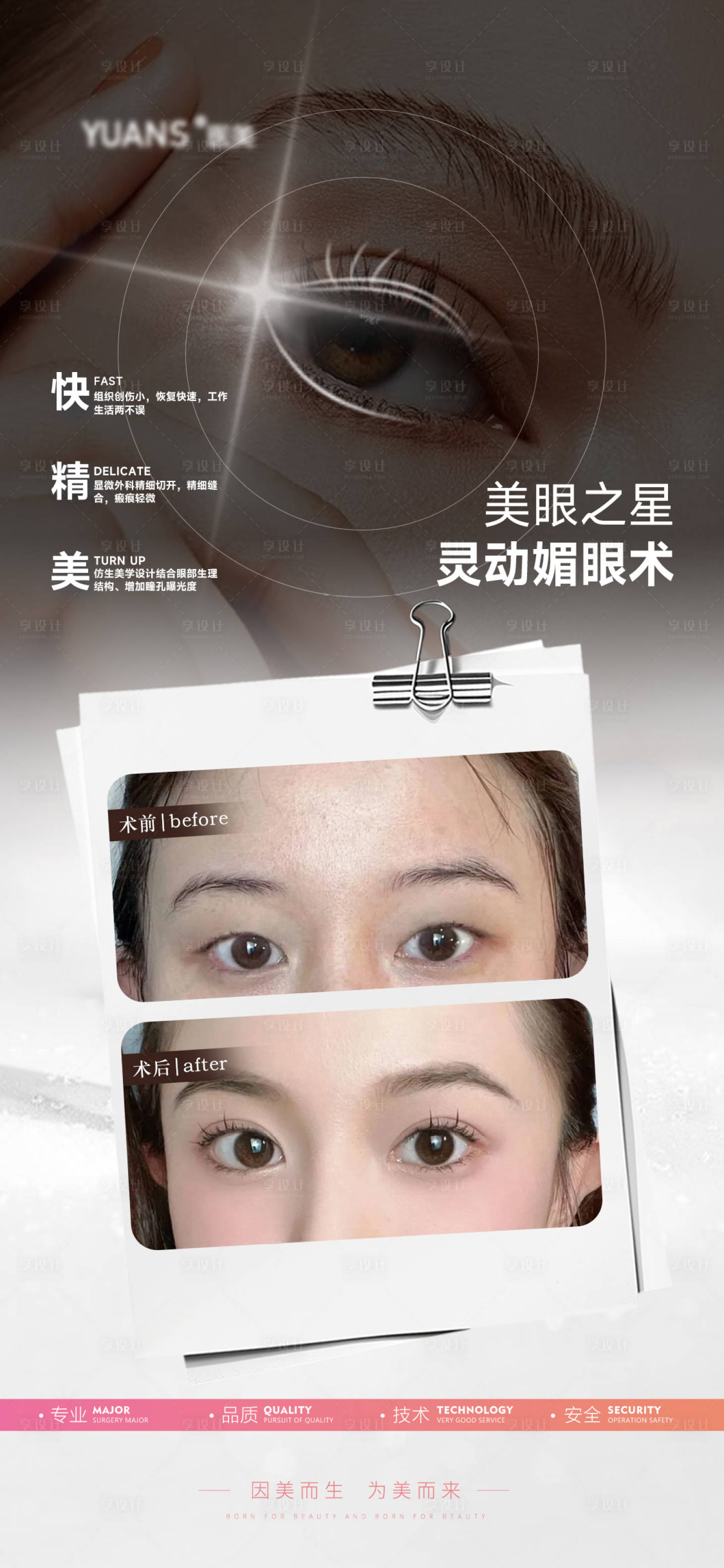 源文件下載【享設(shè)計(jì)】搜索編號(hào)：28230029933793025【醫(yī)美雙眼皮案例對(duì)比】