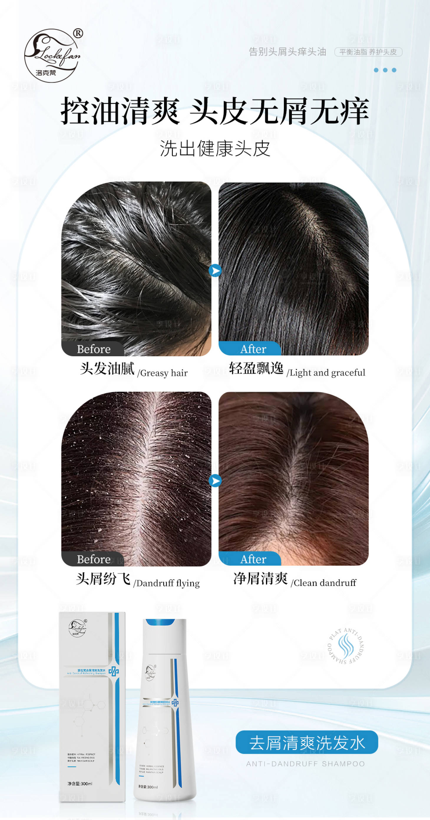 源文件下载【享设计】搜索编号：66420029965348501【头皮案例对比海报】