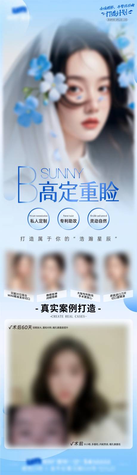 源文件下载【双眼皮】编号：87340030111429924
