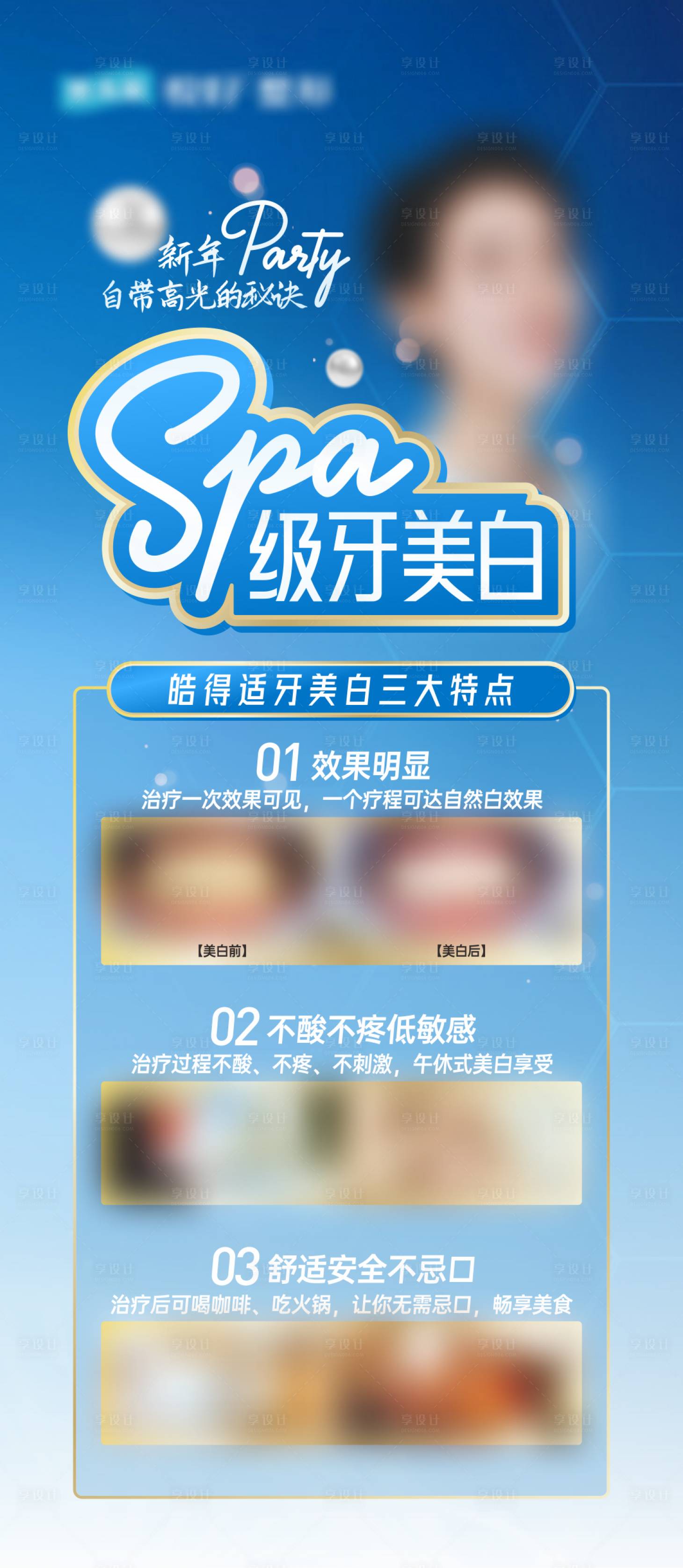 源文件下载【SPA牙美白】编号：19760029916646543