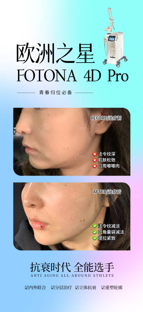 源文件下载【欧洲之星案例对比】编号：75910030345231102