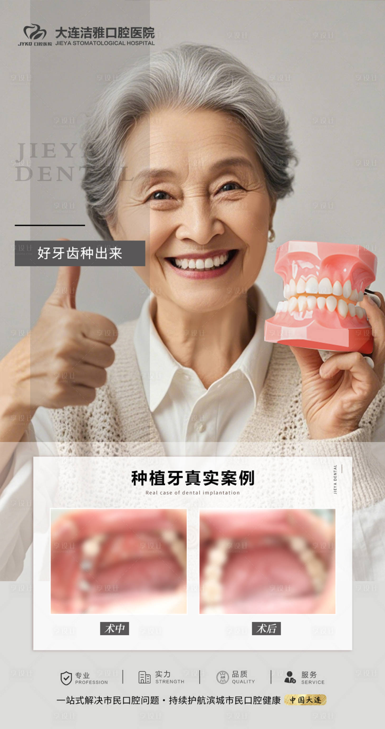 源文件下载【享设计】搜索编号：22980030274573380【口腔种植牙案例对比人物海报】