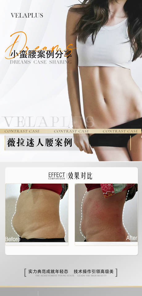 源文件下載【醫(yī)美腰腹前后對比海報(bào)】編號：17350030030743705