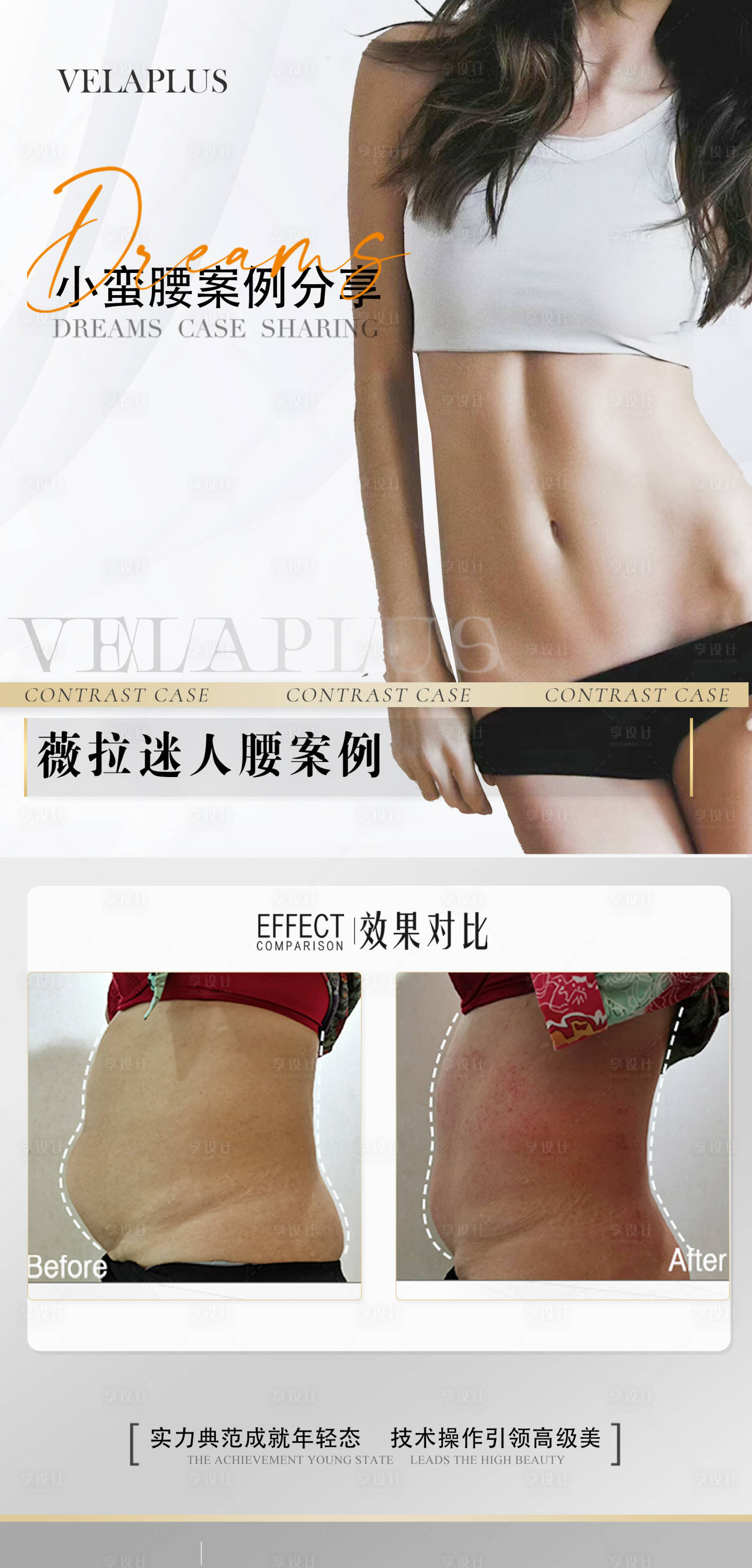 源文件下載【醫美腰腹前后對比海報】編號：17350030030743705
