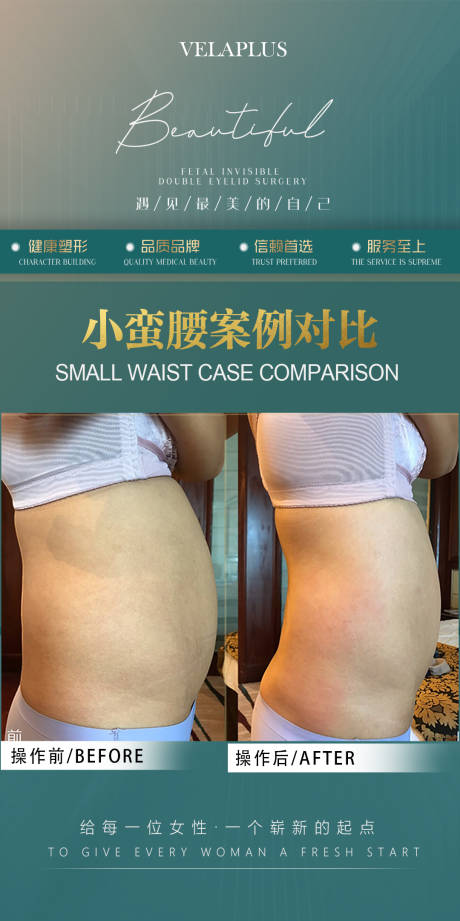 源文件下载【医美腰腹前后对比海报】编号：10640030030653014
